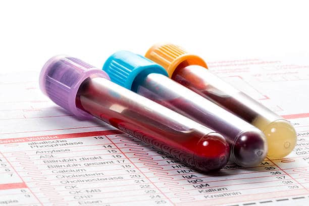 My Jaw DROPPED when I Tested Someone's Immune System After the 2nd Jab - Fringe News